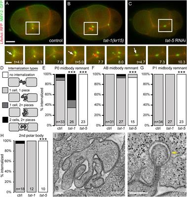 Loss of the Major Phosphatidylserine or Phosphatidylethanolamine Flippases Differentially Affect Phagocytosis